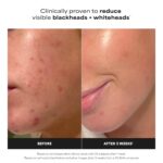 Paula's Choice SKIN PERFECTING 2% BHA Liquid Exfoliant with Salicylic Acid, Facial Polish for Pores, Wrinkles & Fine Lines, Suitable for Blackhead-Prone Skin, Fragrance-Free - Image 3