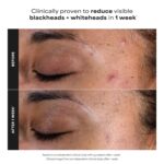 Paula's Choice SKIN PERFECTING 2% BHA Liquid Exfoliant with Salicylic Acid, Facial Polish for Pores, Wrinkles & Fine Lines, Suitable for Blackhead-Prone Skin, Fragrance-Free - Image 5