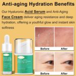 Lifting & Firming Anti-Aging Skin Care Set Kit for Women Teens,Niacinamide Retinol Serum,Hyaluronic Acid Serum,Skincare Gift Set,Facial Skin Care Products,Face Care Routine Kit Christmas Gift Women - Image 5