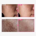 TOSOWOONG Arbutin 7% + Tranexamic Acid 4% Cream, 70,000ppm Arbutin, 40,000ppm TXA, Niacinamide, Glutathione, Dark Spots, Freckle, Blemishes, Pigmentation, Korean Skin Care, 50ml, 1.69 fl.oz. - Image 3