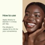 Plant Therapy Zit Fighter Essential Oil Blend Pre-Diluted Roll-On 10 mL (1/3 oz) 100% Pure Essential Oils, Natural Skin Care for Blemish Prone Skin - Image 3