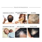 DISAAR BEAUTY Natural Hair Growth Serum with Ginger Essential Oil - Anti Hair Loss Essence for Healthy, Strong, and Thick Hair Growth, Treats Baldness and Weak Brittle Hair - Image 3